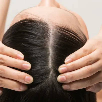 chute de cheveux LARA SENSE