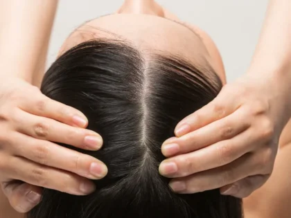 chute de cheveux LARA SENSE